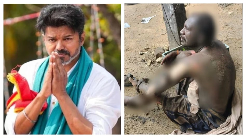 सरकार गठन में देरी से व्यथित सख्श ने खुद को लगाई आग, डरावना हुआ चेहरा, हालत नाजुक